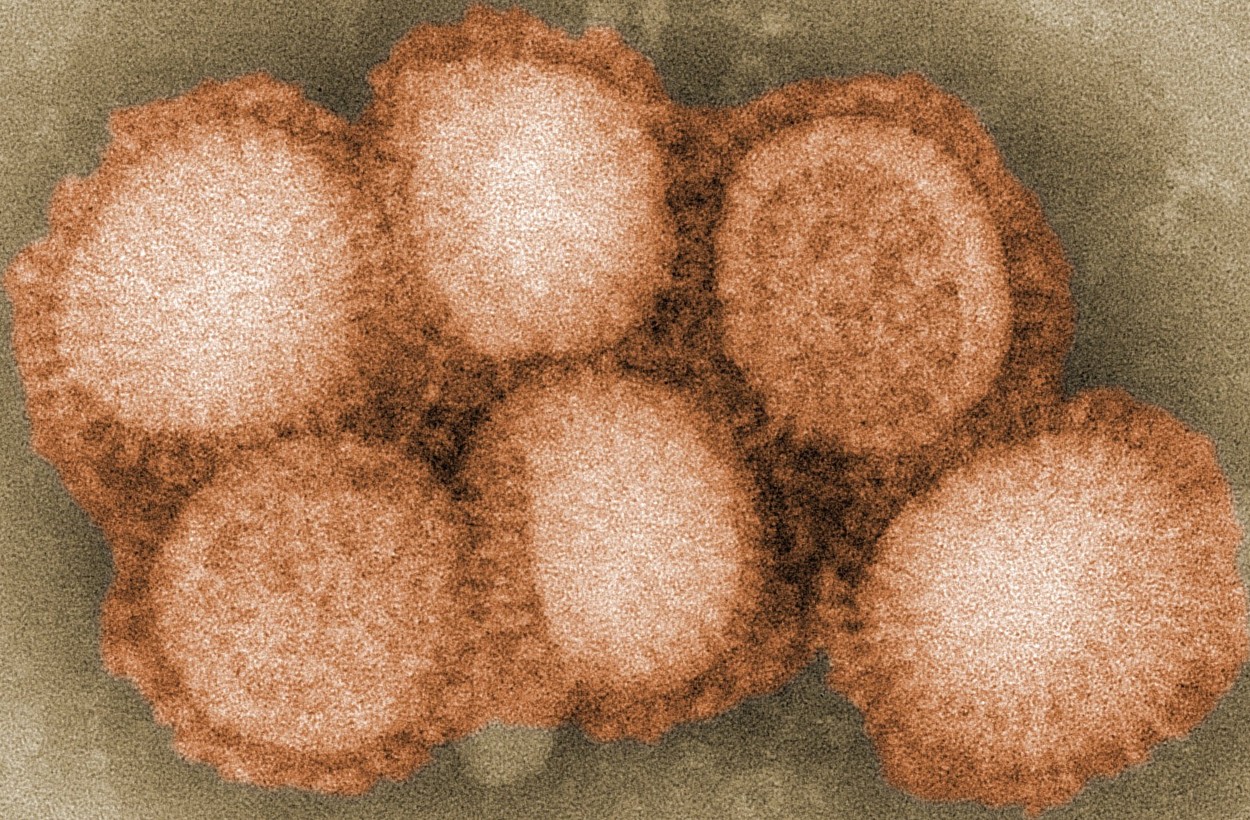 H1N1型インフルエンザウイルス